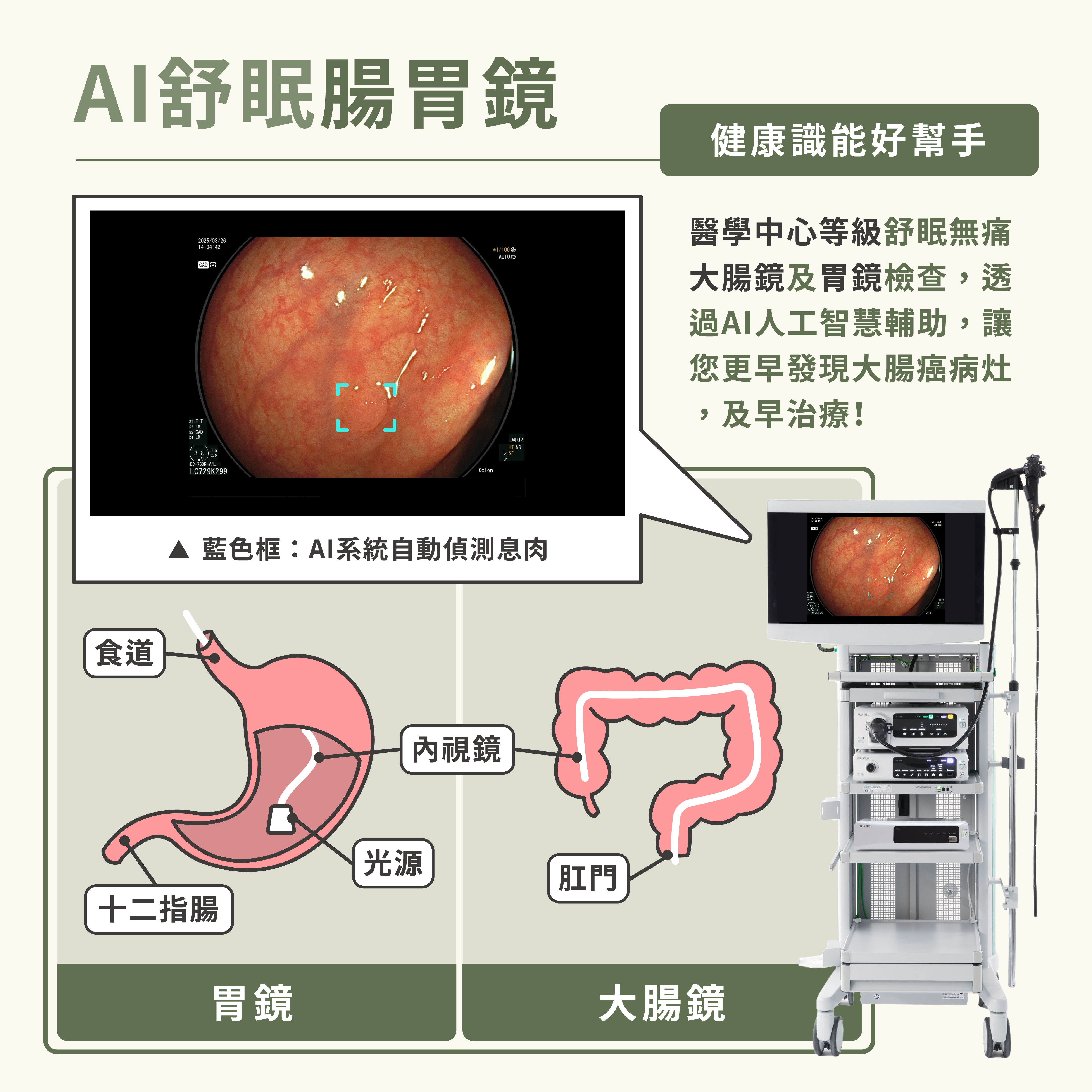 AI舒眠腸胃鏡